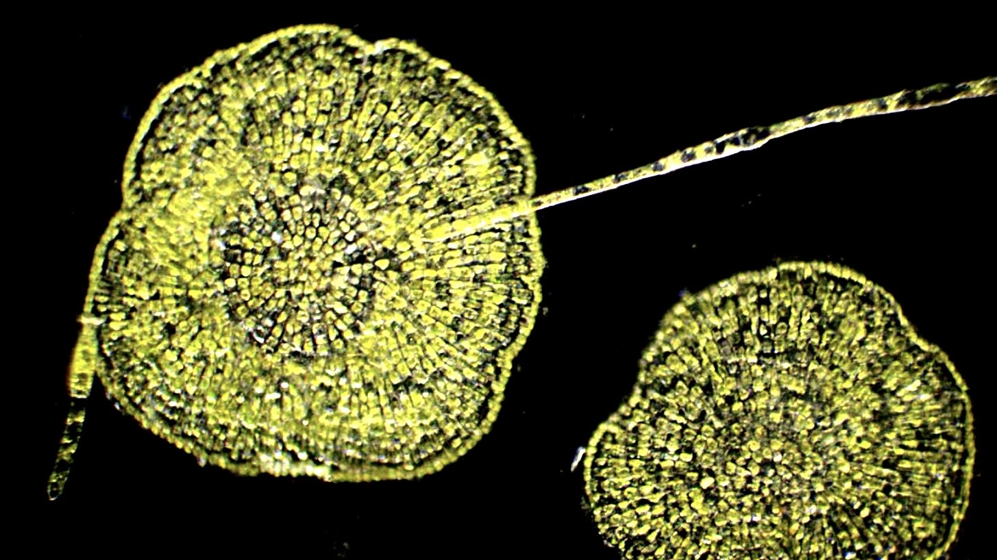 Darkfield micrograph displaying two glowing yellow-green Coleochaete disk-shaped algal colonies against a stark black background, connected by a long, slender filament.