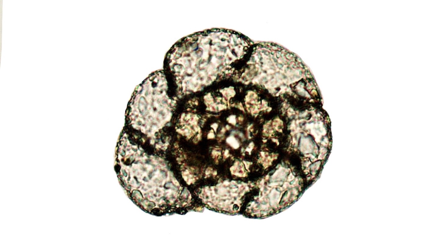 Micrograph of a spiral, coiled foraminiferan shell on a white background, composed of distinct, granular chambers divided by dark, defined suture lines.