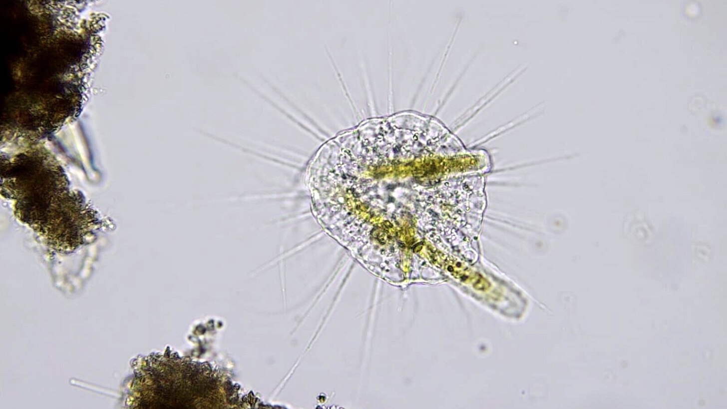 Light micrograph showing a round, translucent heliozoan with fine, radiating axopodia extending outward, engulfing green cylindrical diatoms within its central body.