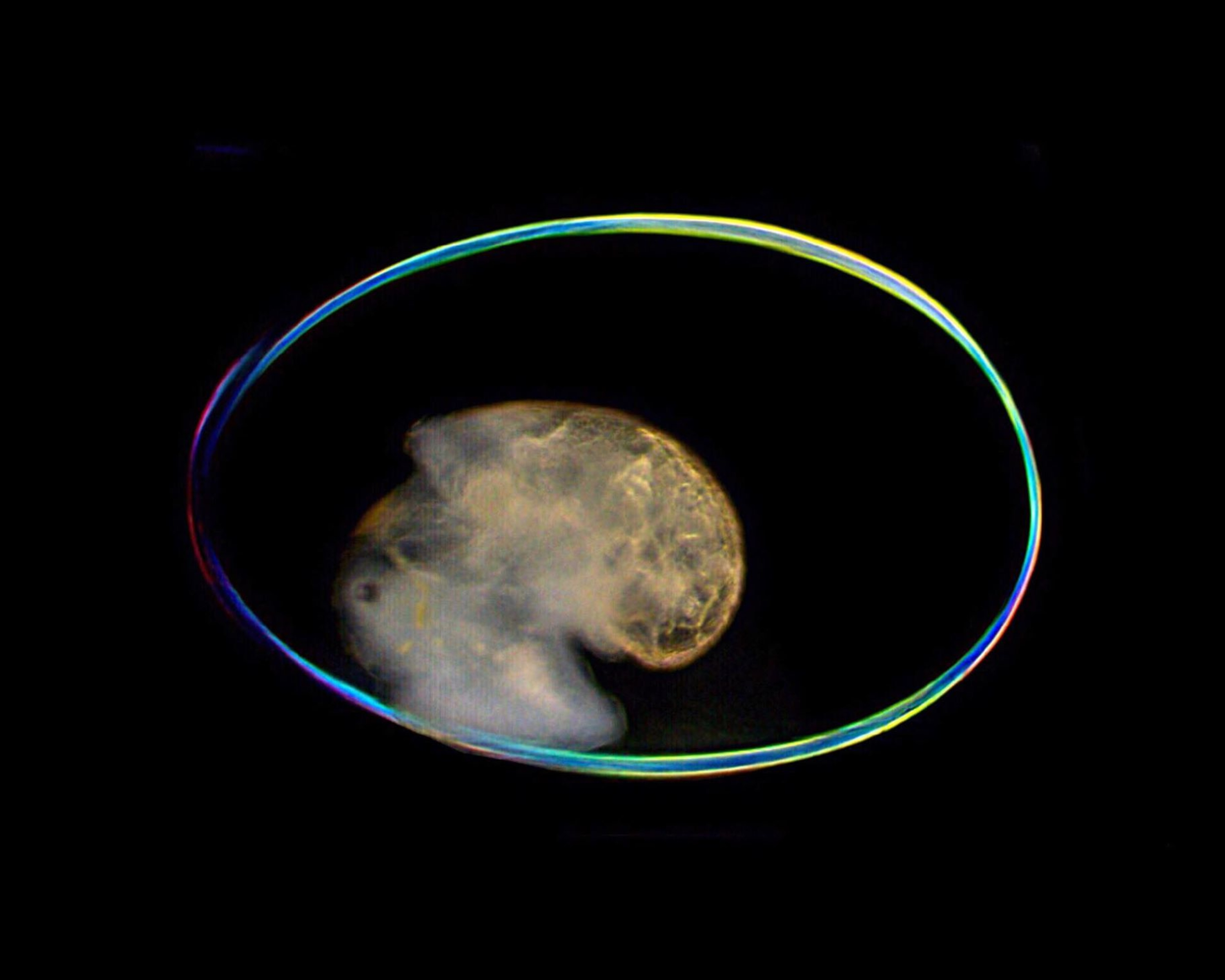 Micrograph set against a dark background, showing a transparent oval snail egg shell enclosing a developing snail embryo in its center.