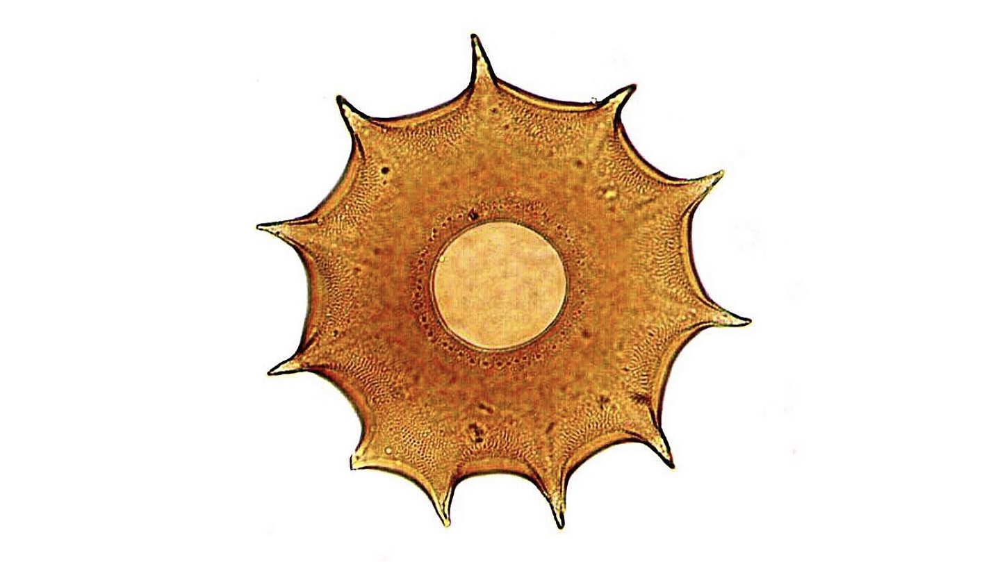 Brightfield micrograph featuring the star-shaped, brownish shell of an Arcella testate amoeba, centered on a stark white background with sharp radial spines around its edge and a central aperture.