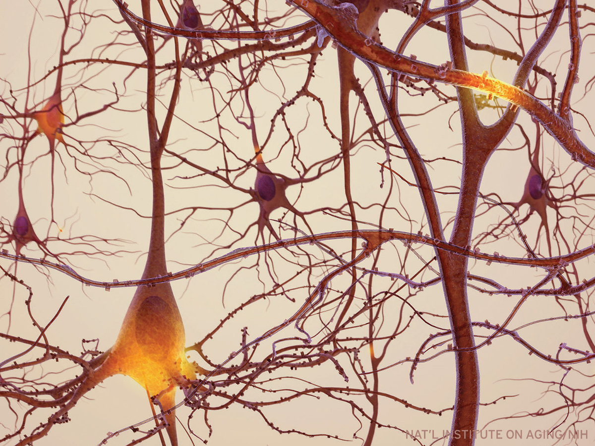 Neurons. Credit: National Institute on Aging/NIH