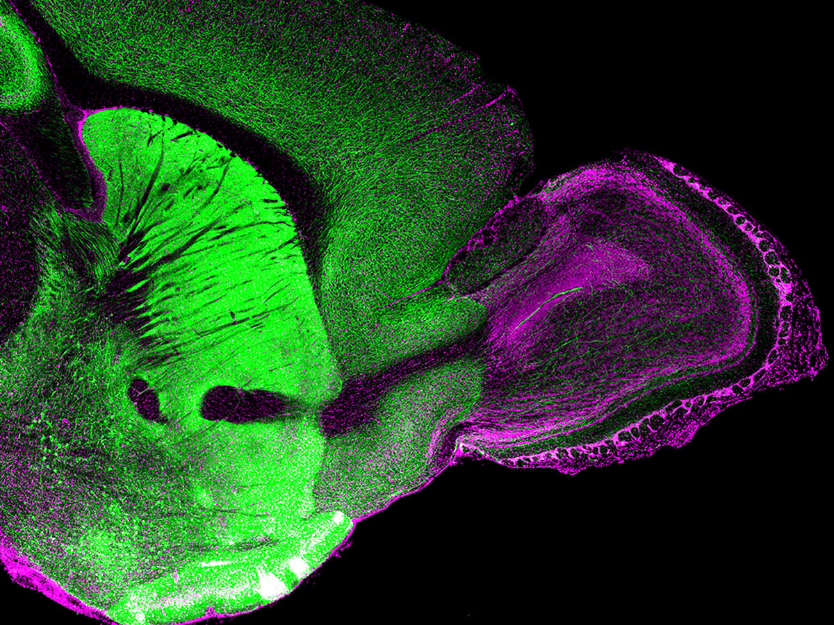 Extensive innervation by cholinergic neurons of the basal forebrain