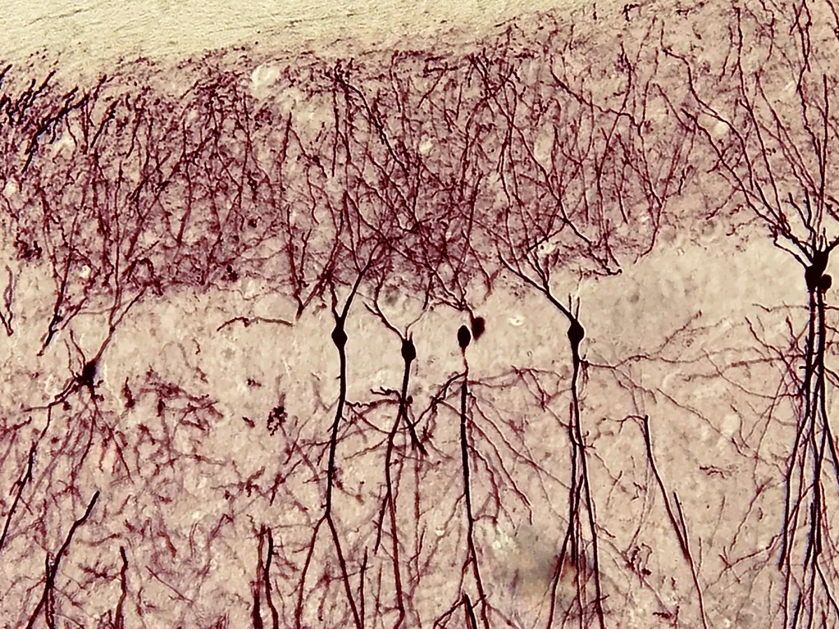 Auditory neural pathways