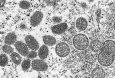 Monkeypox virus particles