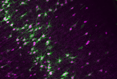 Parvalbumin expressing neurons in the gerbil auditory cortex (magenta) surrounded by perineuronal nets (green).