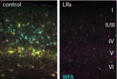 Photomicrographs of the visual cortex