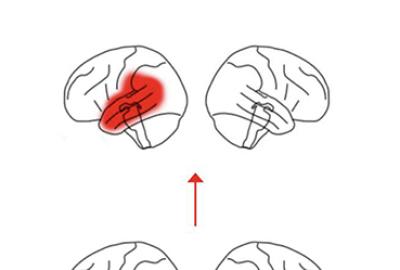 brain images