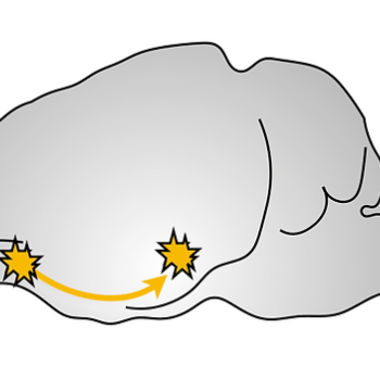 Brain Diagram of OFC