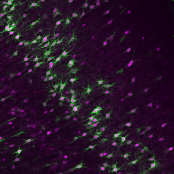 Parvalbumin expressing neurons in the gerbil auditory cortex (magenta) surrounded by perineuronal nets (green).