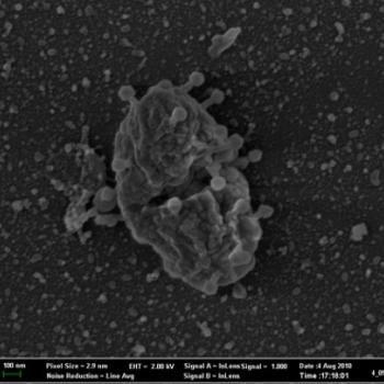 Scanning electronmicrograph of a virus infecting and blasting open a cell.